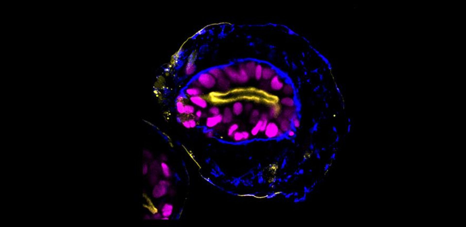Δημιουργία μοντέλων που μοιάζουν με ανθρώπινα έμβρυα από βλαστικά κύτταρα για την κατανόηση των πρώτων σταδίων της ανθρώπινης ανάπτυξης